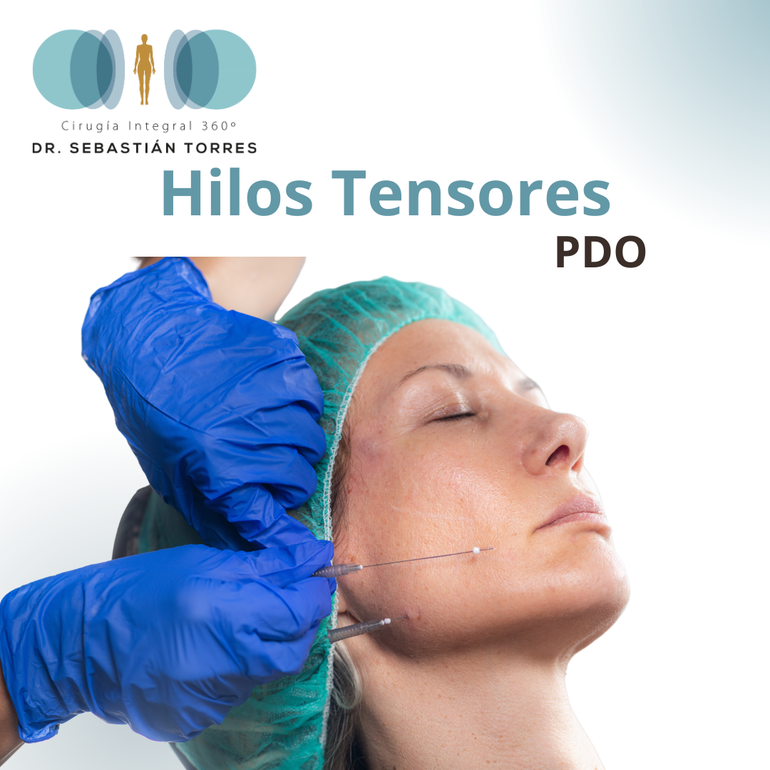 Hilos Tensores en PDO