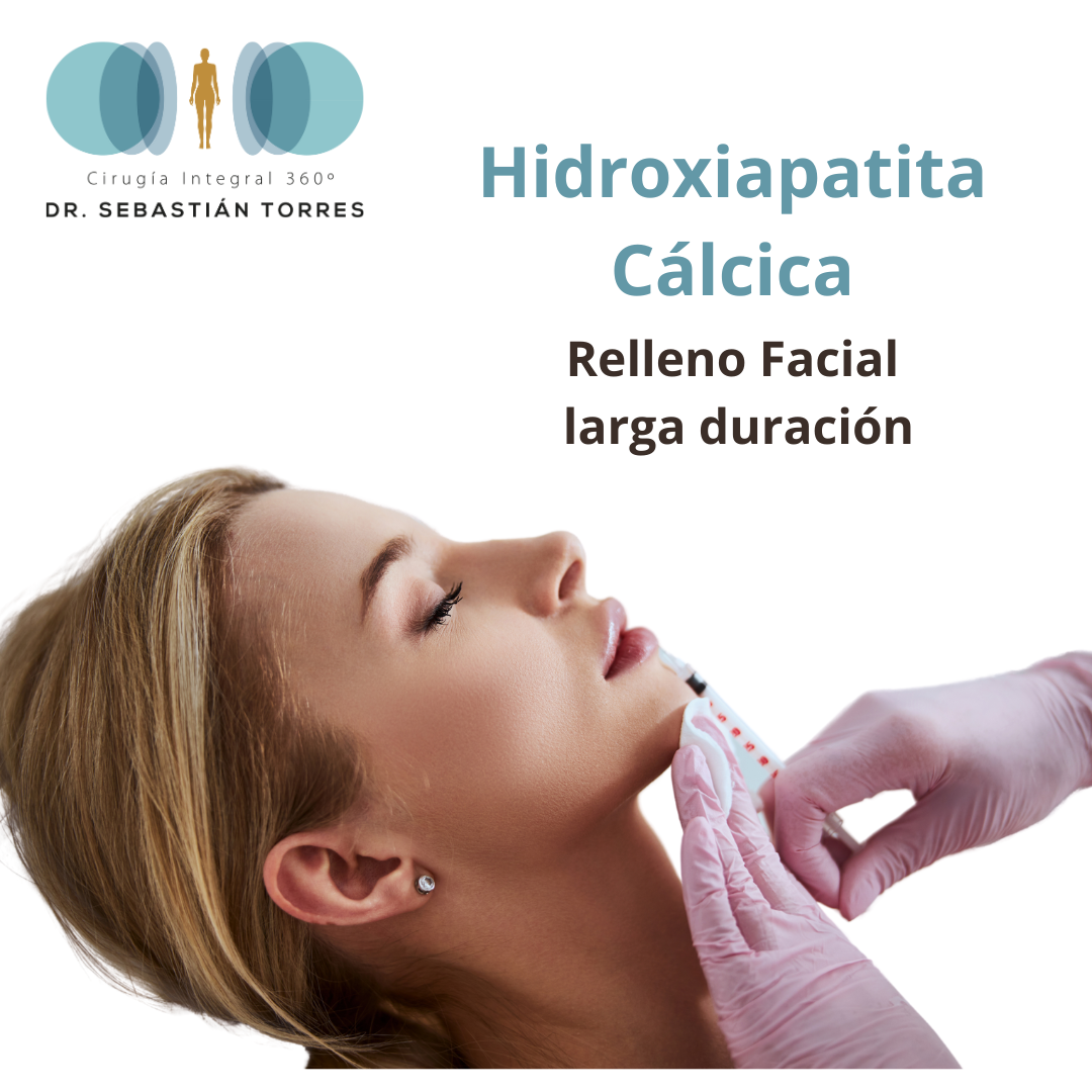 Hidroxiapatita Cálcica - Relleno facial larga duración efecto inmediato