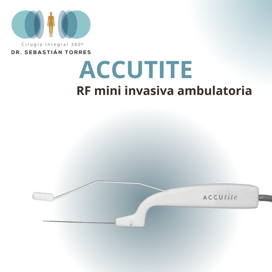 Accutite-RF interna lifting no quirurgico