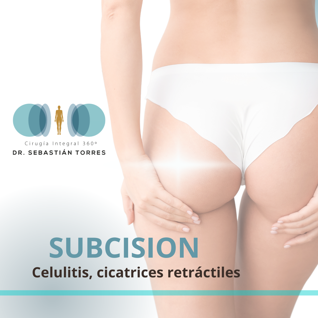 Subcisión - celulitis y cicatrices