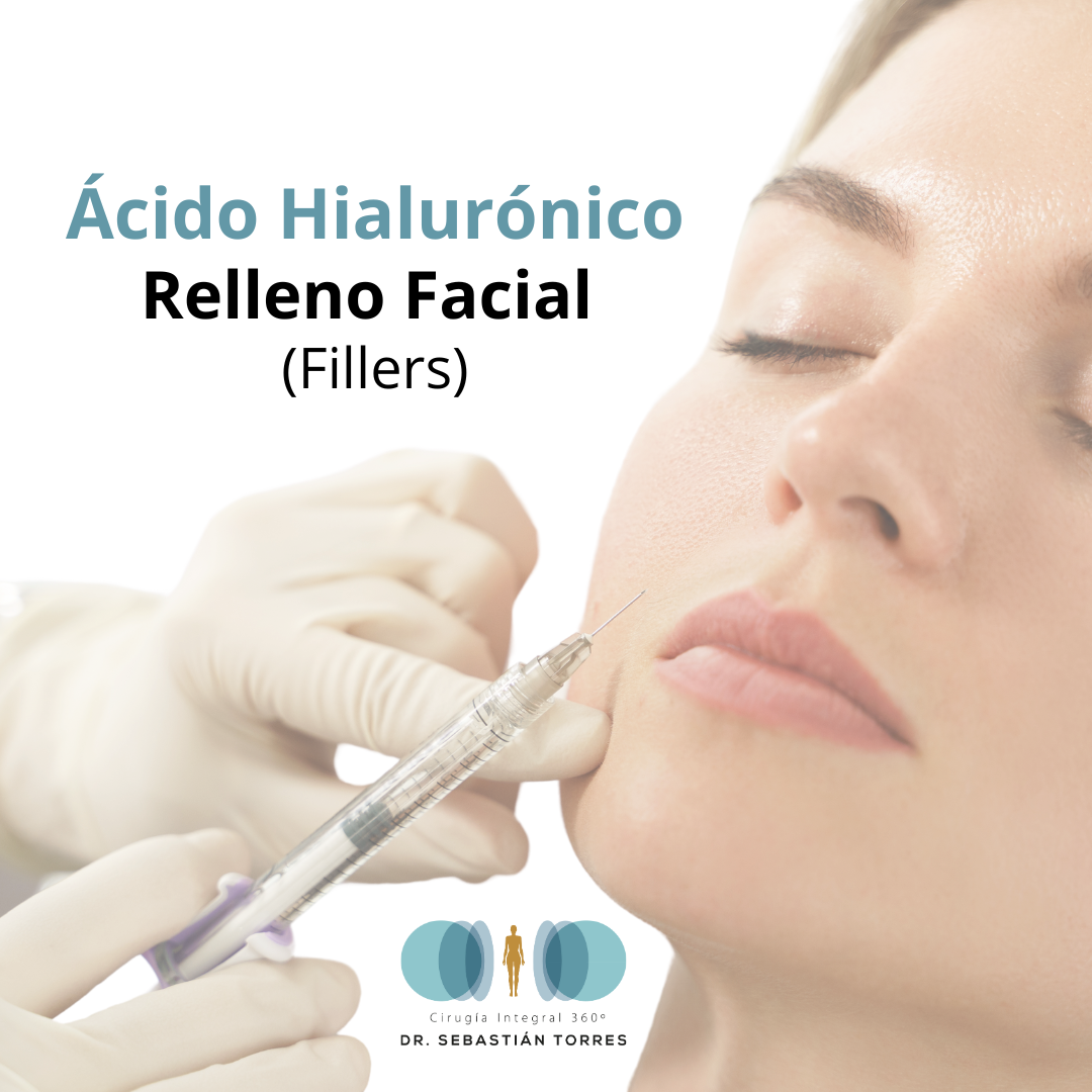 Acido hialúronico (filler) Relleno facial (salvo nariz y ojeras)