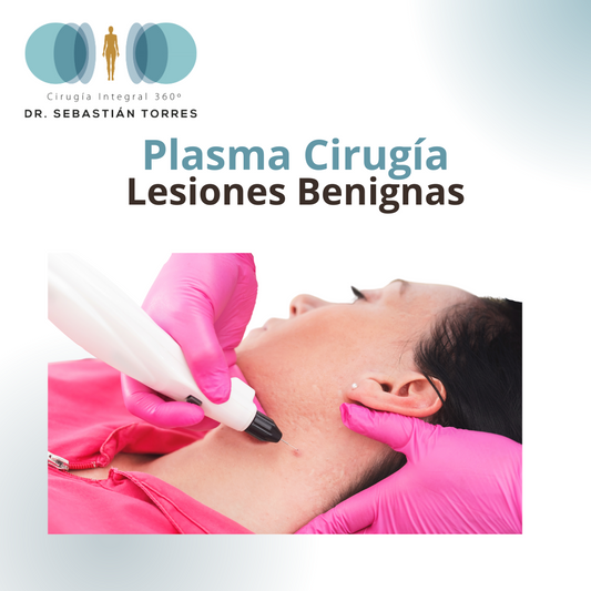 Plasma Fulguración lesiones benignas piel